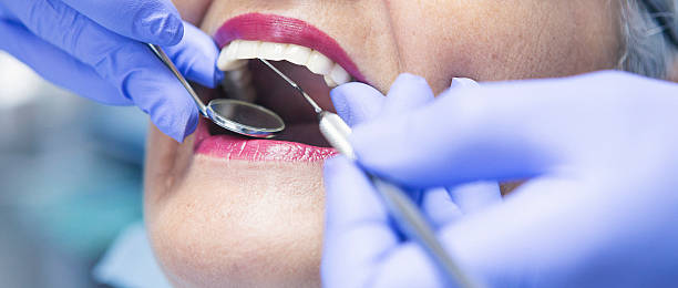 Best Emergency Dental Extractions in Swansboro, NC