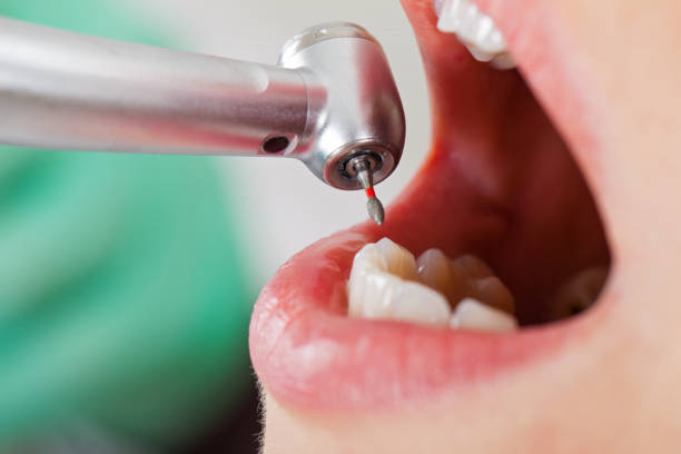 Best Emergency Dentist for Knocked-Out Tooth in Swansboro, NC